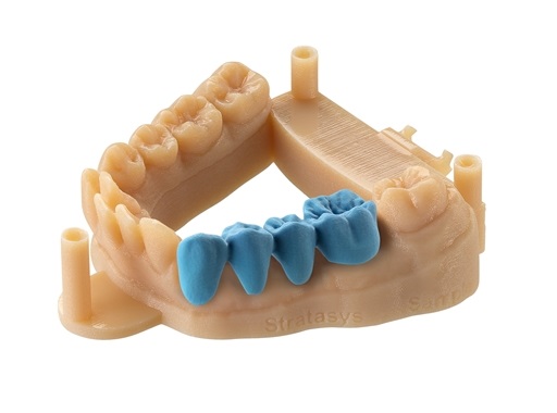 модель печать на 3д принтере для стоматологии